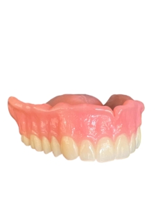 Digital Complete Denture1